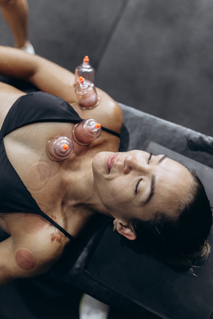 Close-up of woman receiving cupping therapy on her back in a wellness clinic.
